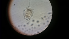 Lecane quadridentata