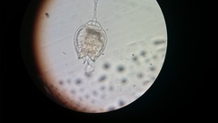 Lecane quadridentata