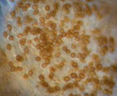 Cortinarius gentilis