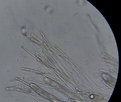 Dissingia crassitunicata