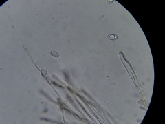 Dissingia crassitunicata