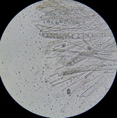 Dissingia crassitunicata