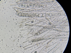 Dissingia crassitunicata