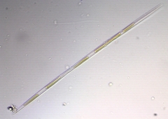 Pseudo-nitzschia