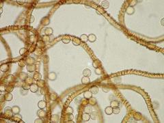 Arcyria stipata