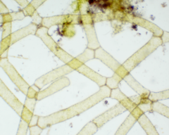 Hydrodictyon reticulatum