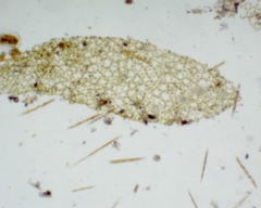 Hydrodictyon reticulatum