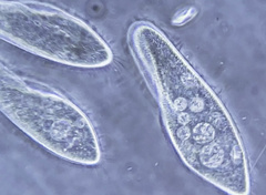 Paramecium aurelia