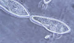 Paramecium aurelia