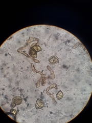 Phaeomegaceros hirticalyx