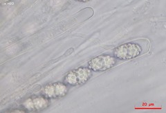 Trichophaeopsis paludosa