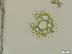 Lacunastrum gracillimum