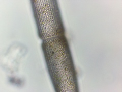 Tetmemorus brebissonii