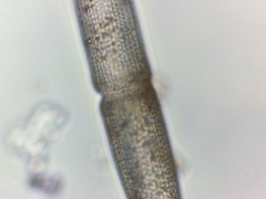 Tetmemorus brebissonii