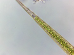 Closterium kuetzingii