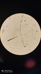 Pseudanabaena