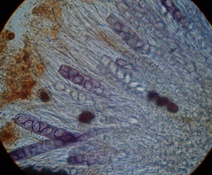 Ascobolus carbonarius