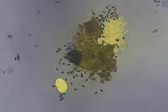 Podospora excentrica