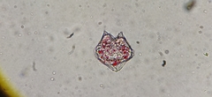 Protoperidinium