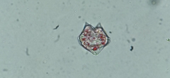 Protoperidinium