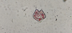 Protoperidinium