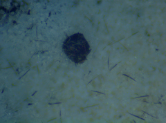 Hypomyces papulasporae