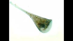 Stentor coeruleus
