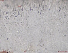 Hymenoscyphus imberbis