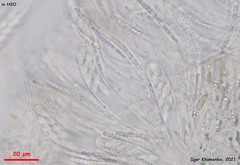 Hymenoscyphus imberbis