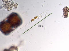 Nitzschia reversa