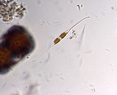 Nitzschia reversa