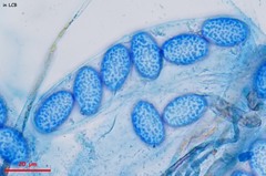 Scutellinia olivascens