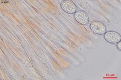 Scutellinia olivascens