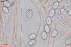 Scutellinia olivascens