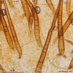 Scutellinia olivascens