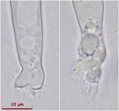 Scutellinia olivascens