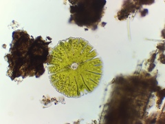 Micrasterias denticulata