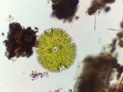 Micrasterias denticulata
