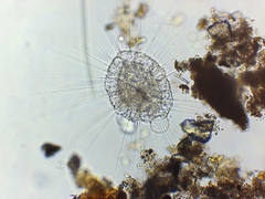 Actinosphaerium