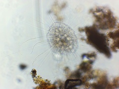 Actinosphaerium