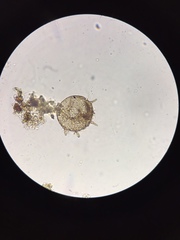 Centropyxis aculeata