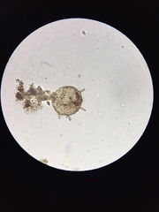 Centropyxis aculeata