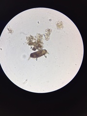 Centropyxis aculeata