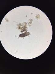 Centropyxis aculeata