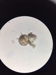 Centropyxis aculeata