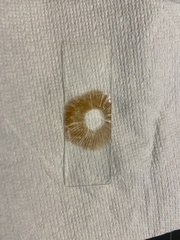 Cortinarius anomalus