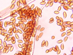 Cortinarius anomalus