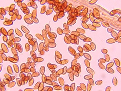 Cortinarius anomalus