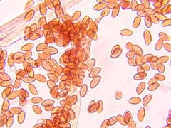 Cortinarius anomalus