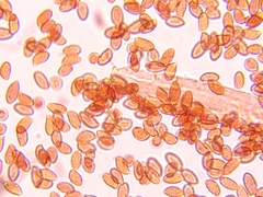 Cortinarius anomalus